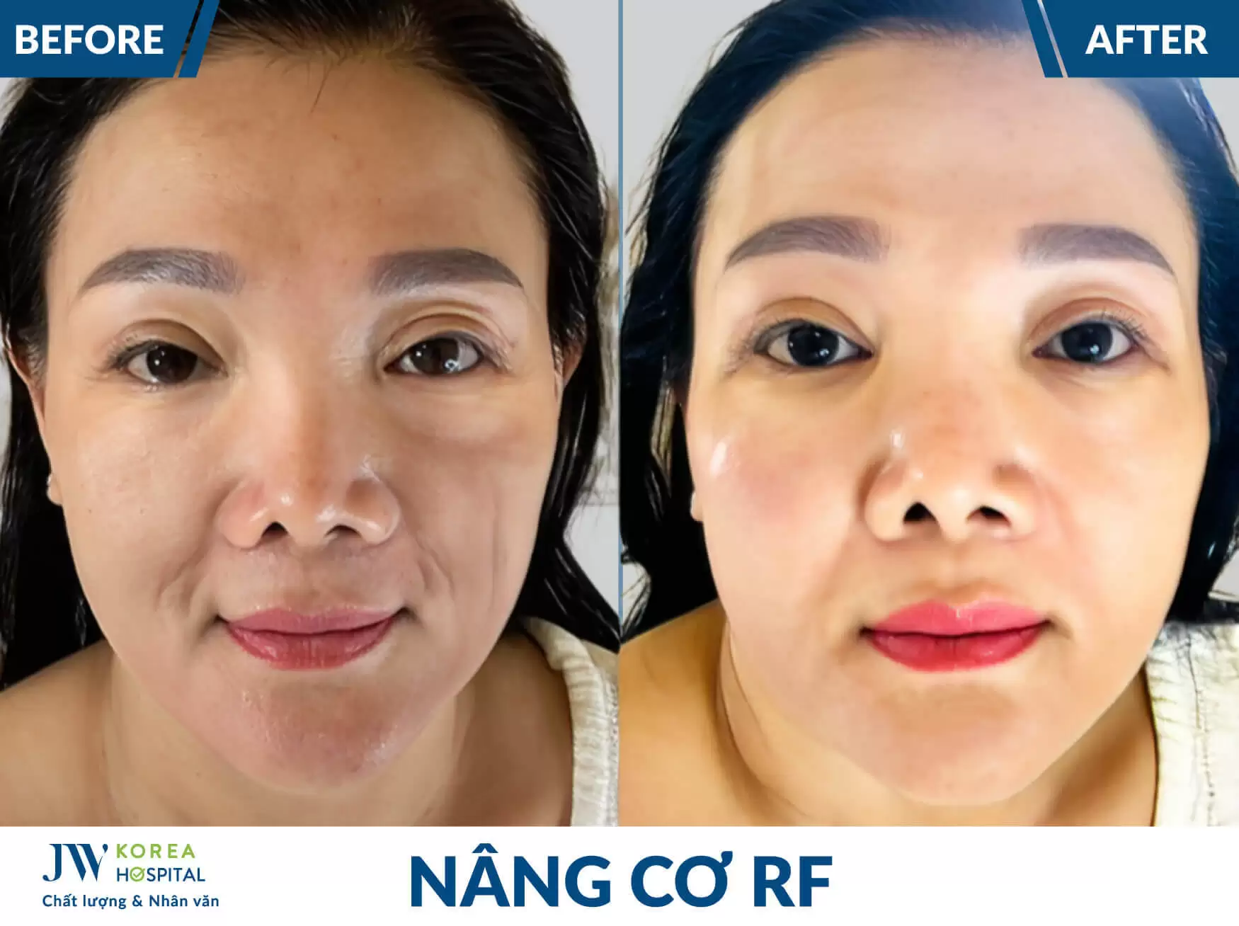 nang co RF