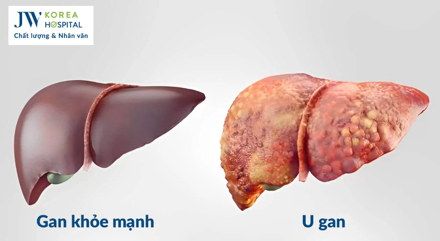 benh-gan