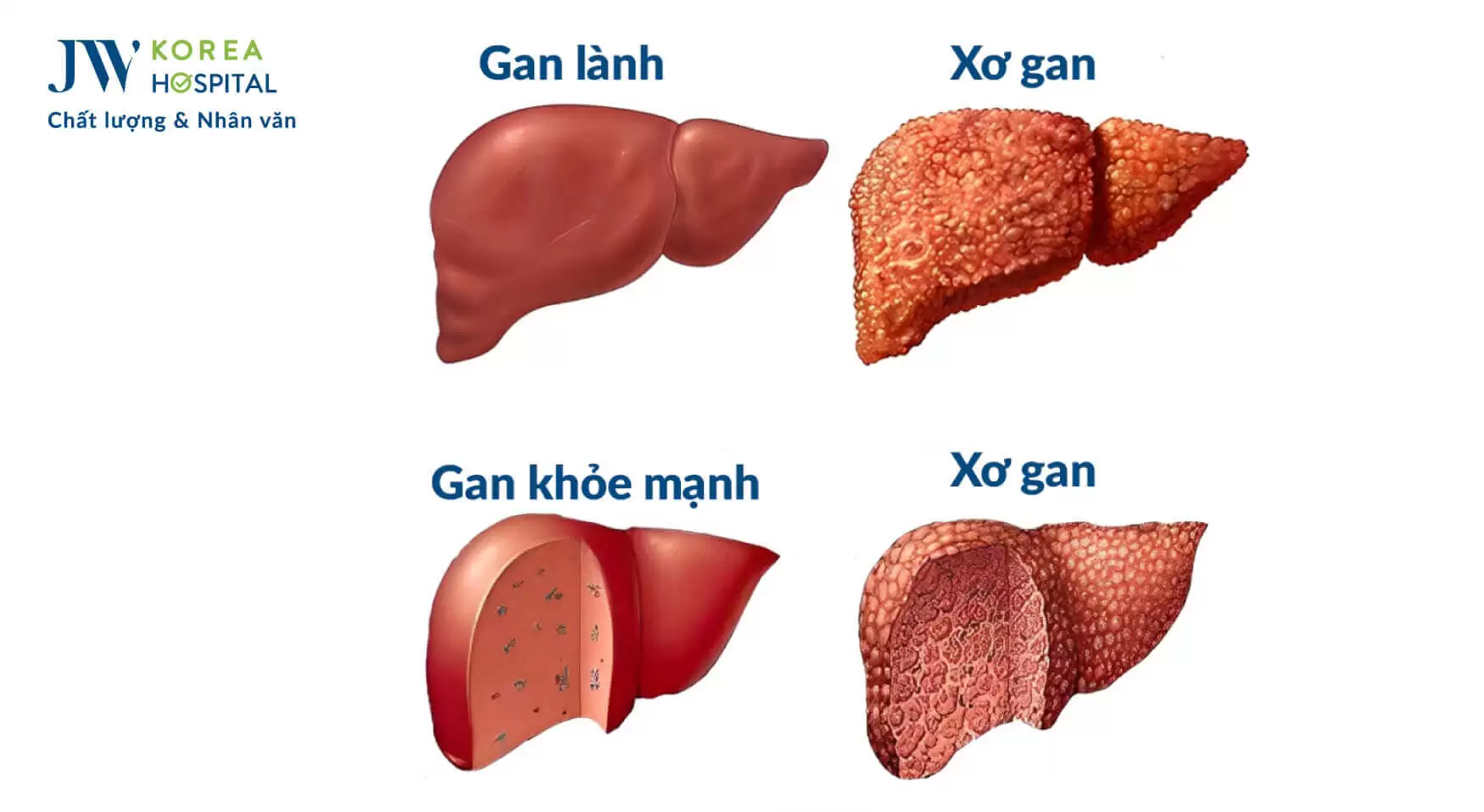 xo-gan