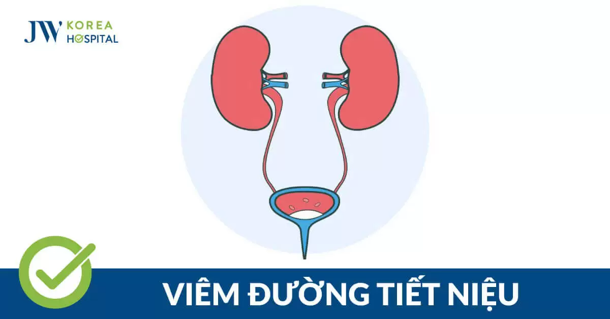 Viêm đường tiết niệu: Nguyên nhân, triệu chứng và giải pháp điều trị tại Bệnh viện JW