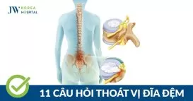 Thoát vị đĩa đệm