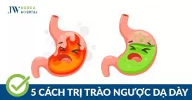 trào ngược dạ dày