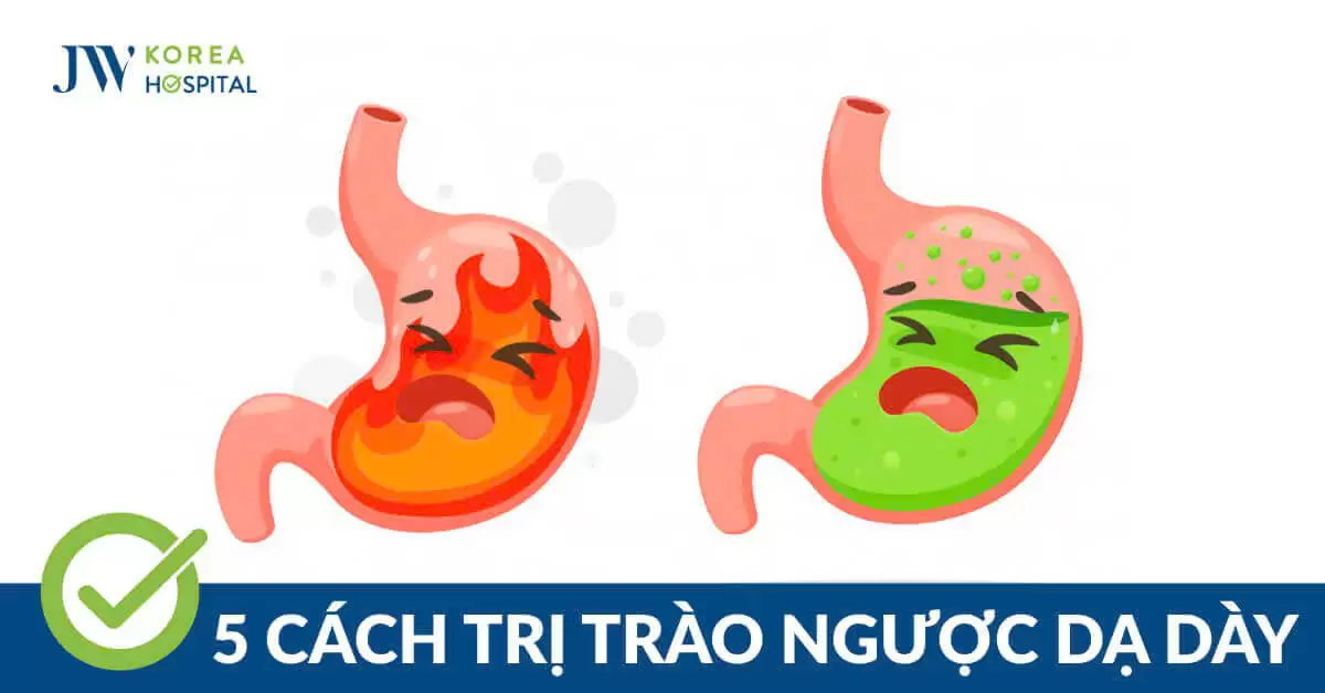 5 cách điều trị trào ngược dạ dày tại nhà: Hiệu quả và dễ thực hiện