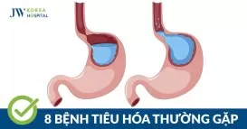 bệnh tiêu hóa