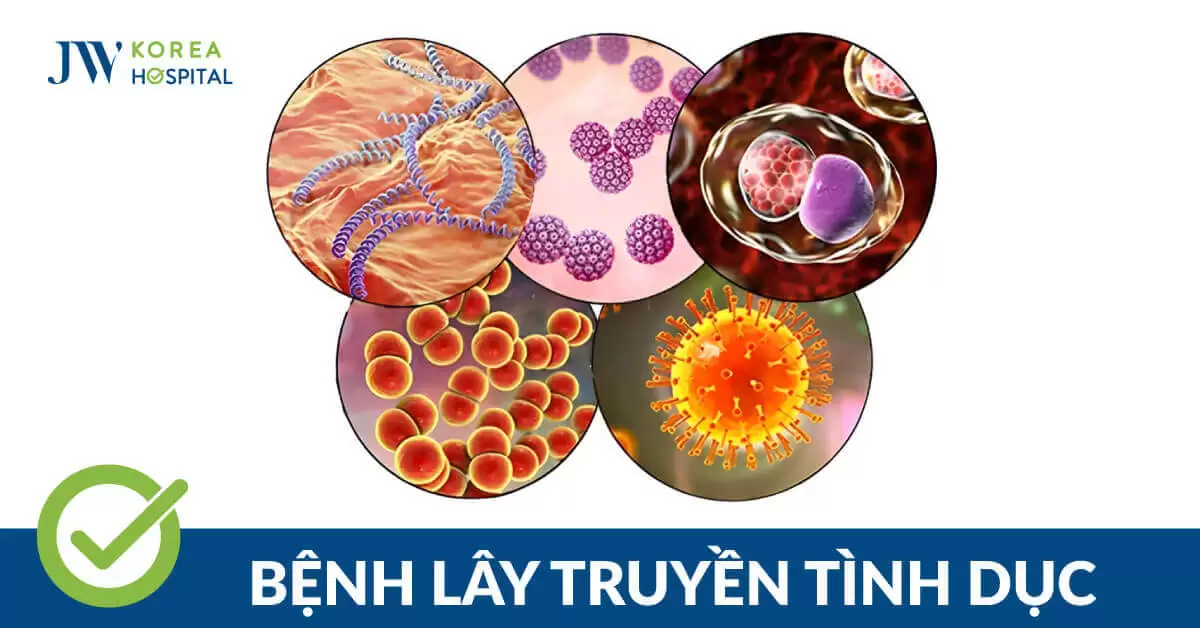 Top 5 Bệnh Tình Dục Ở Nam Giới Thường Gặp Và Cách Điều Trị