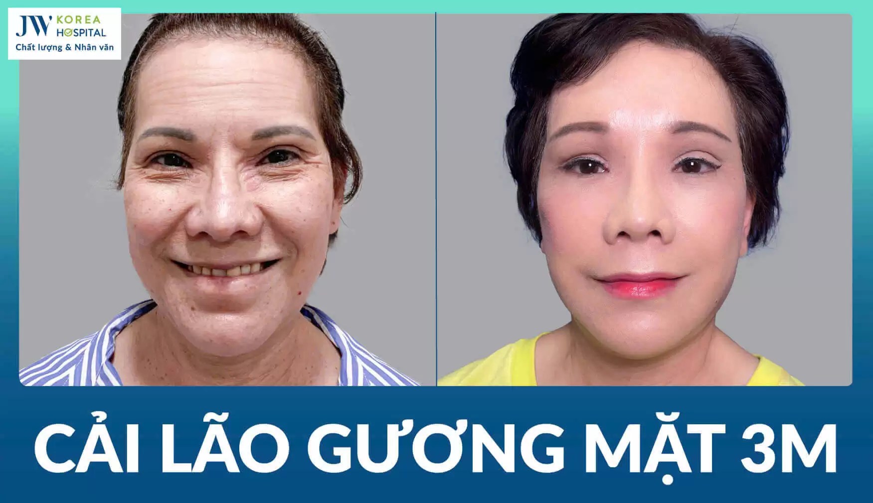 cai-lao-guong-mat
