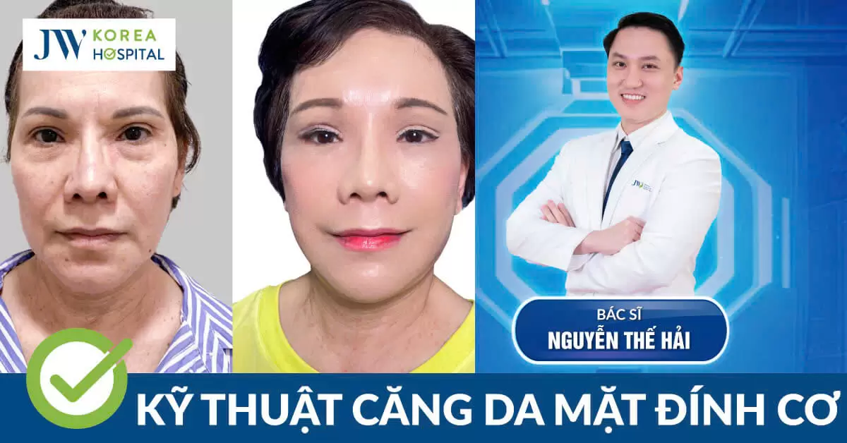 Bác sĩ Thế Hải gây sốt với kỹ thuật Khâu cố định ngoài da trong căng da mặt tại VSAPS 2025