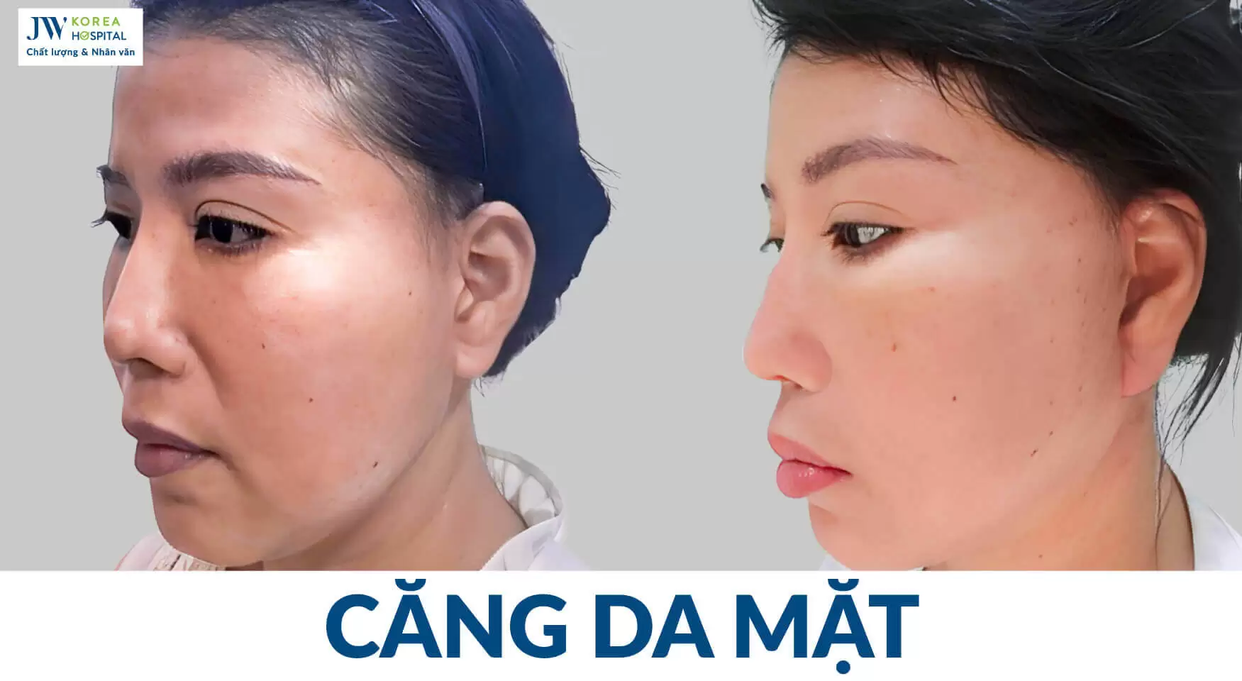 tre hoa guong mat