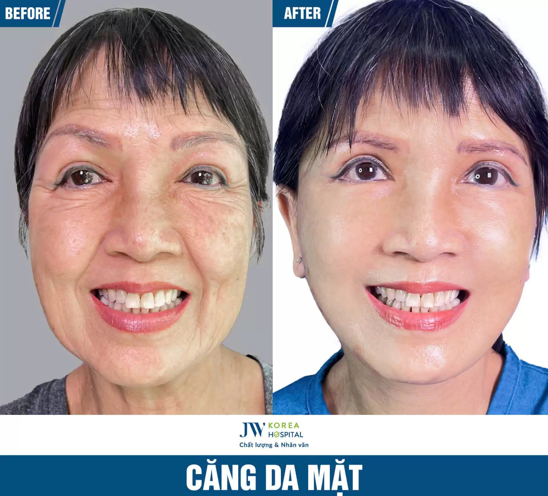 cang-da-mat