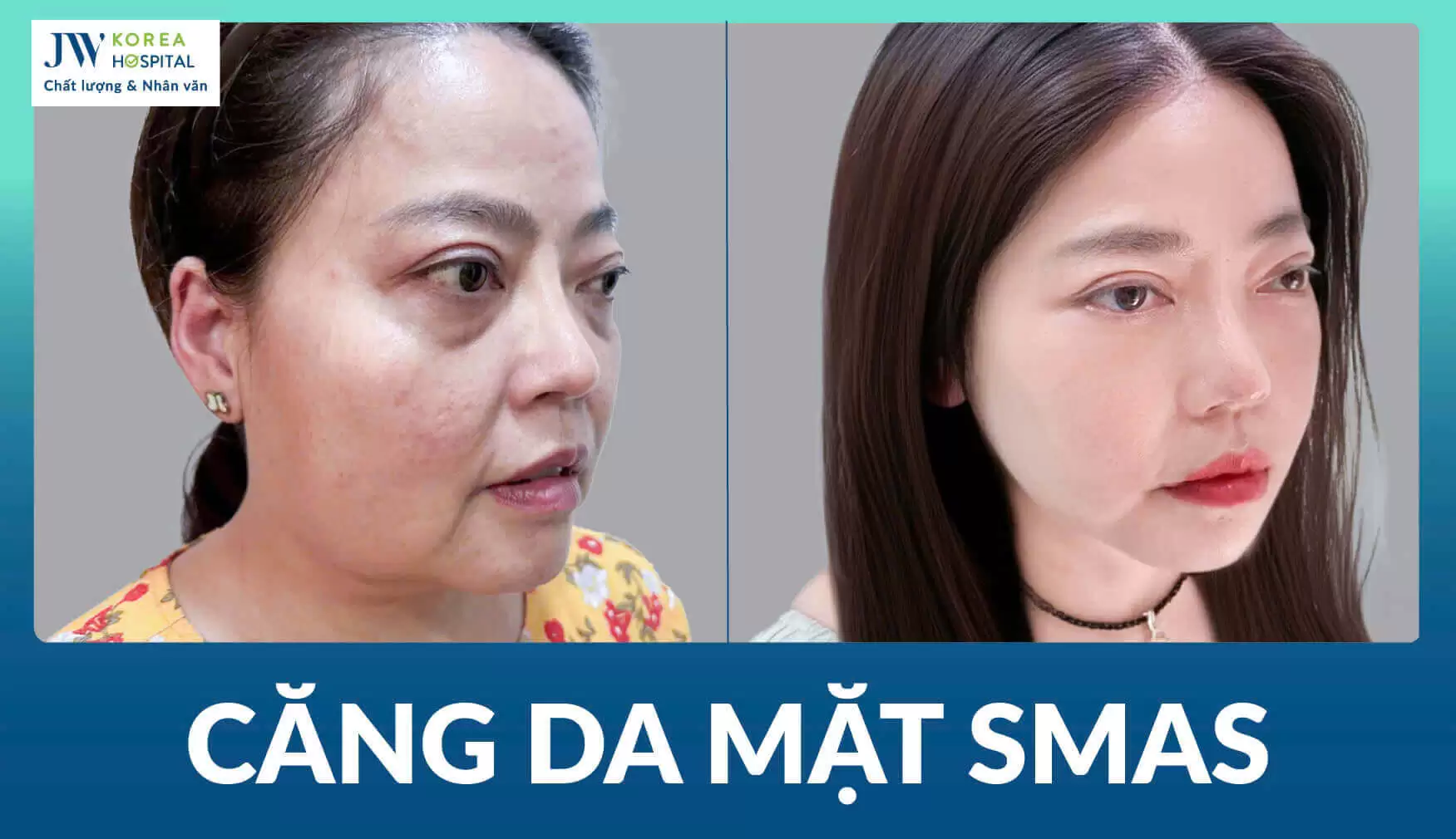cang-da-mat