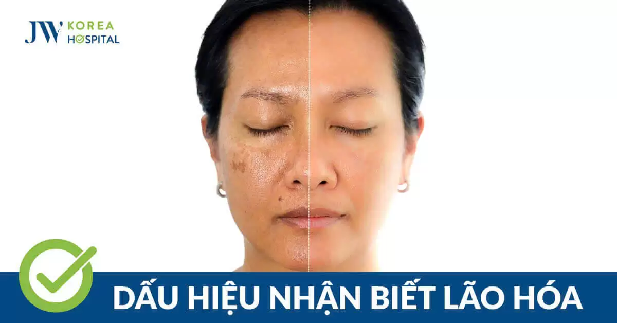 Trẻ hóa làn da tại JW giúp da căng mịn, xóa nếp nhăn lão hóa