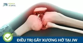 gãy xương hở
