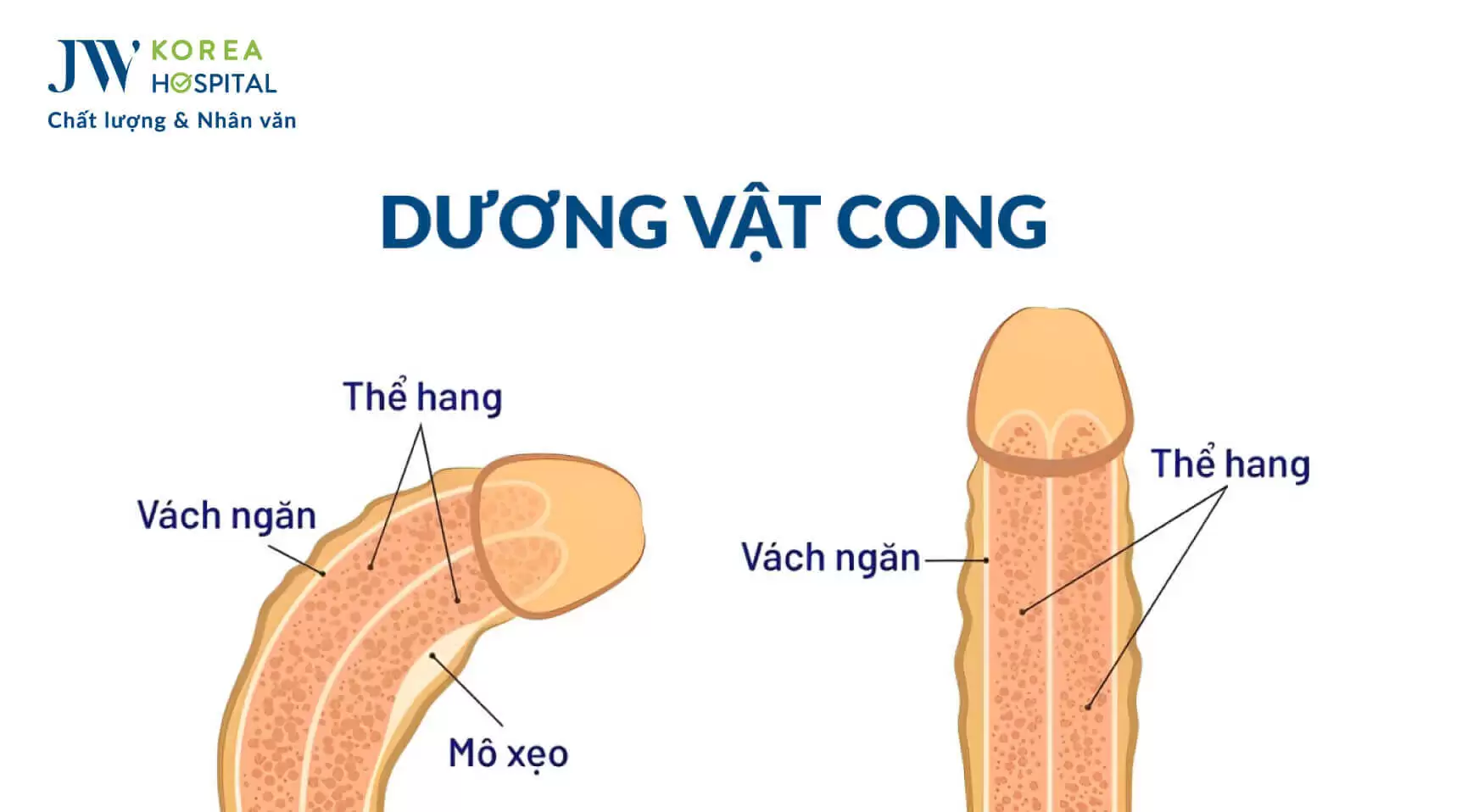 chinh-hinh-duong-vat