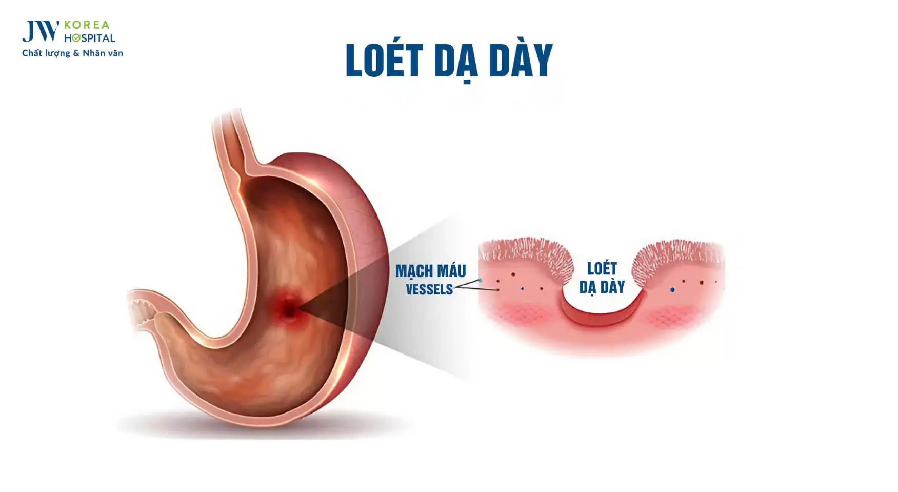 loet-da-day