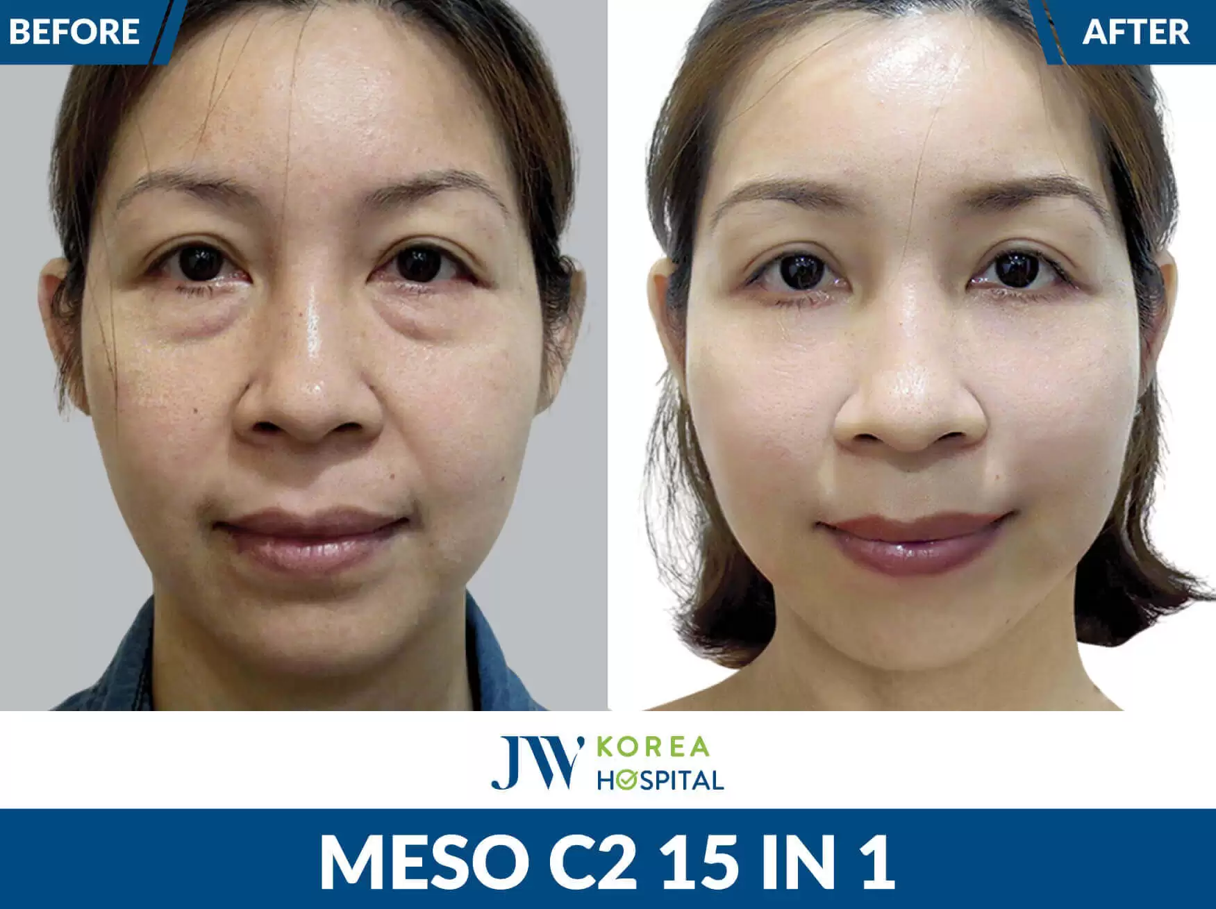 meso-c2