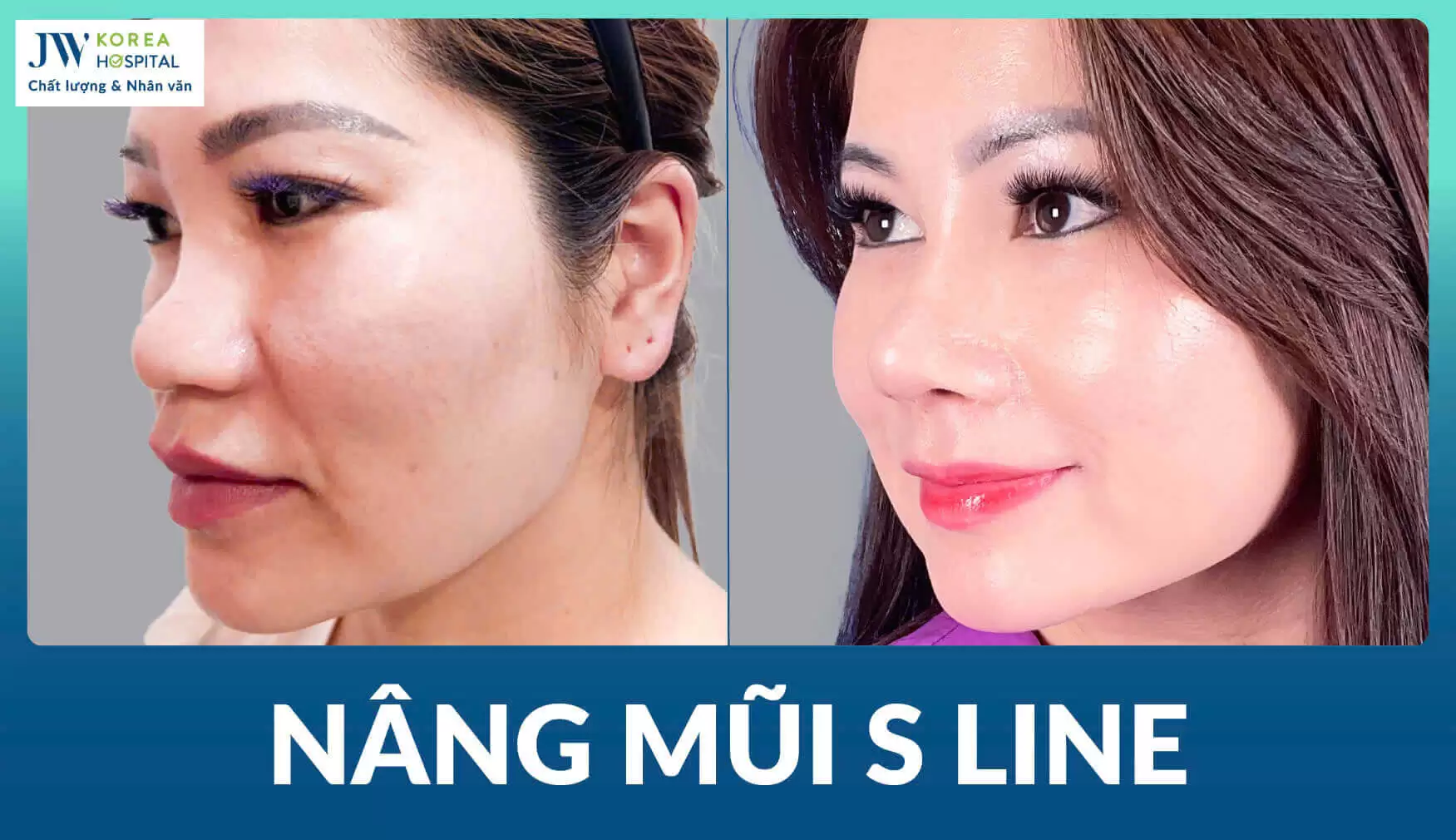 nang-mui-s-line