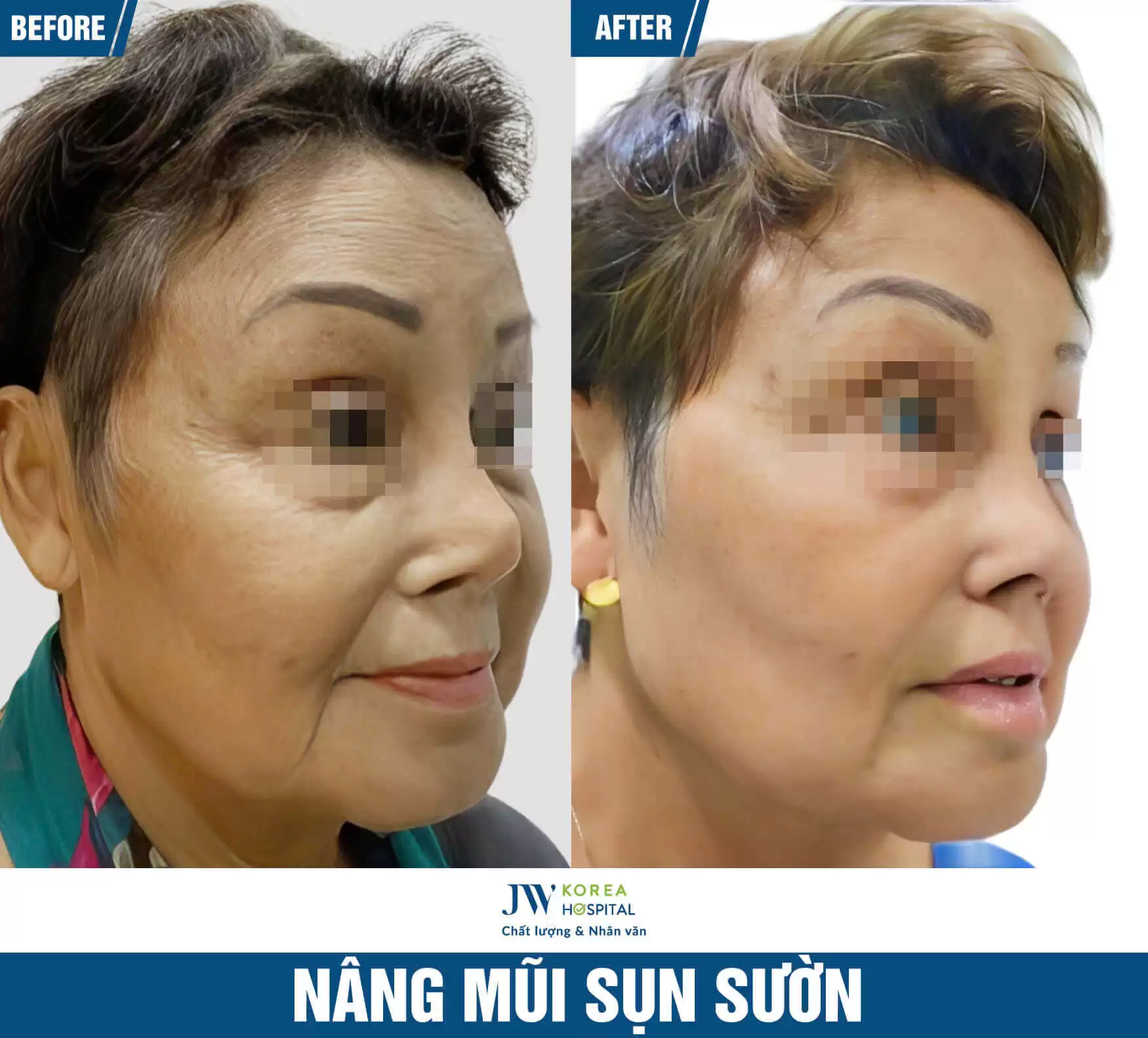 nang-mui-sun-suon
