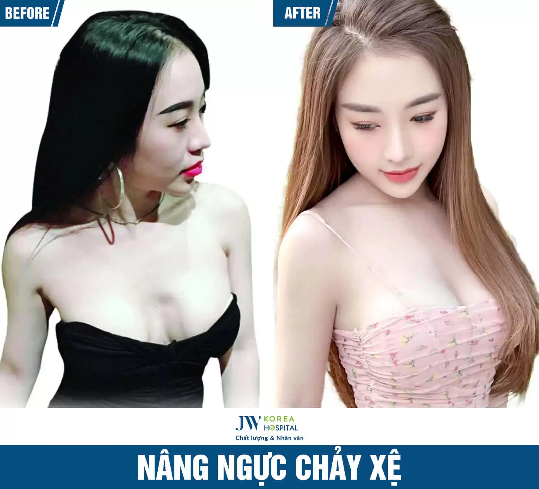 nang-nguc-chay-xe
