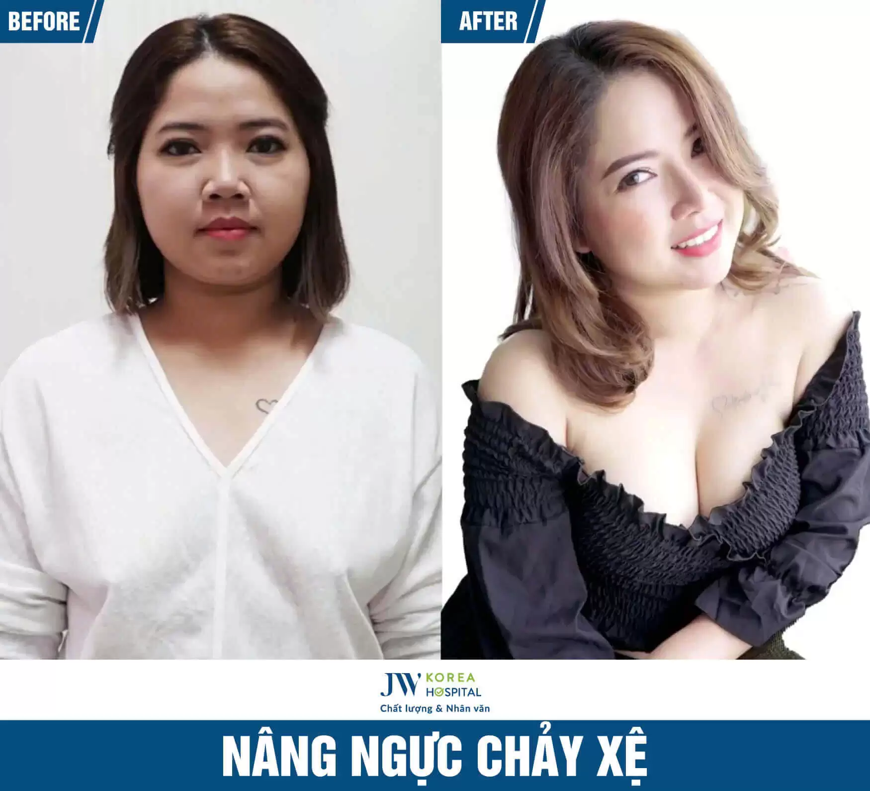 nang-nguc-me-bim