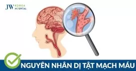 dị tật mạch máu
