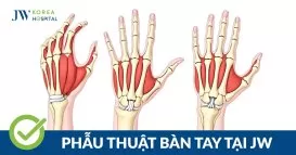 bàn tay