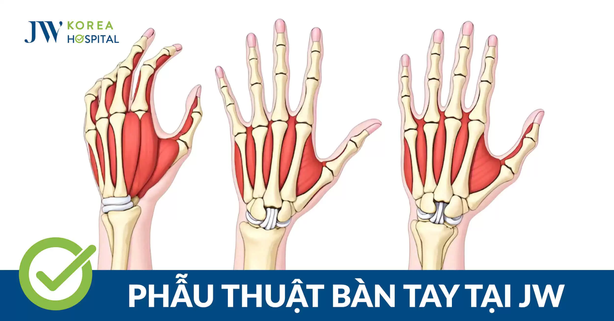 Phẫu Thuật Bàn Tay, Bàn Chân: Hành Trình Phục Hồi Chức Năng và Thẩm Mỹ
