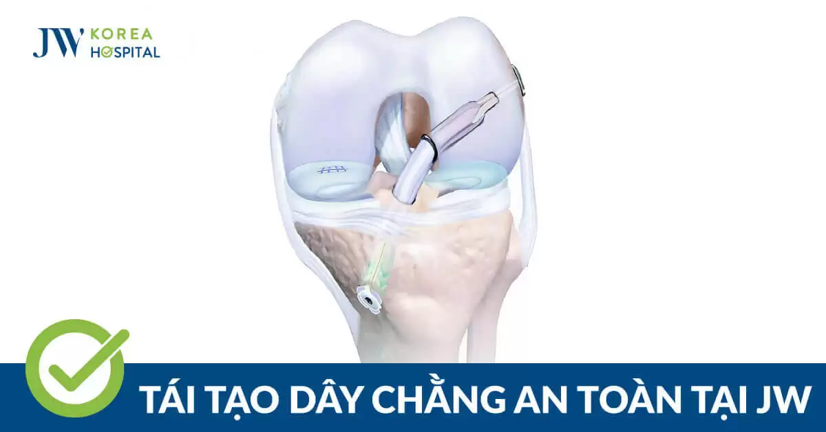 Chấn Thương Thể Thao: Tái Tạo Dây Chằng, Rách Sụn, Viêm Gân Tại JW