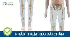 kéo dài chân