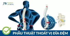 phẫu thuật thoát vị đĩa đệm