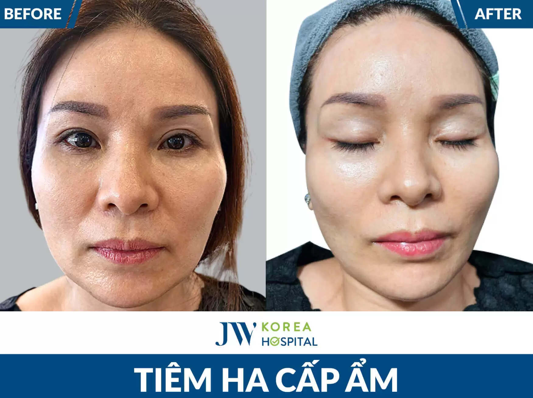 tiem-ha