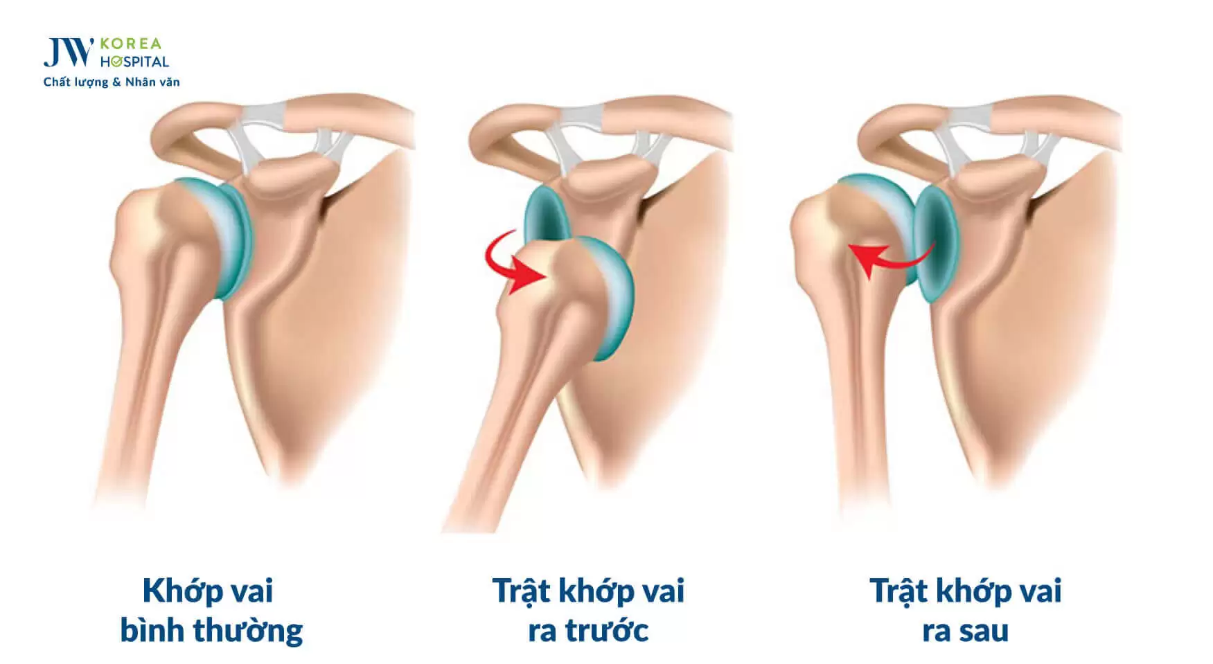 trat-khop-vai
