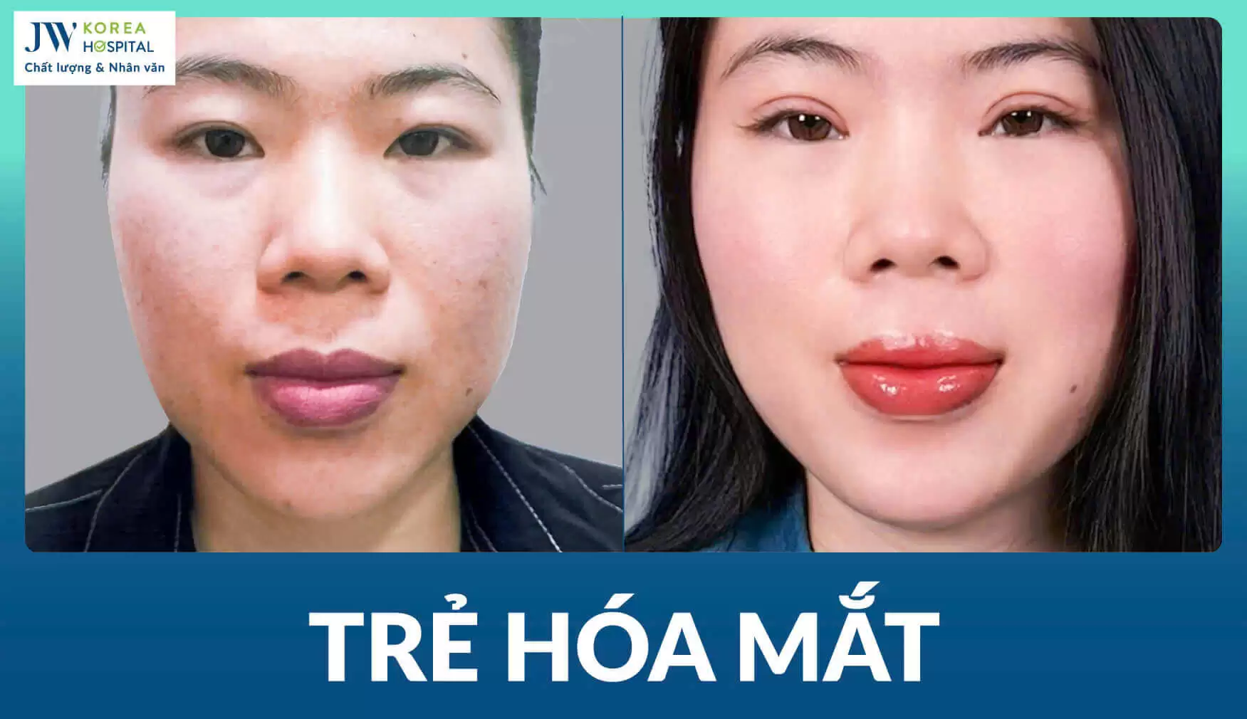 tre-hoa-mat