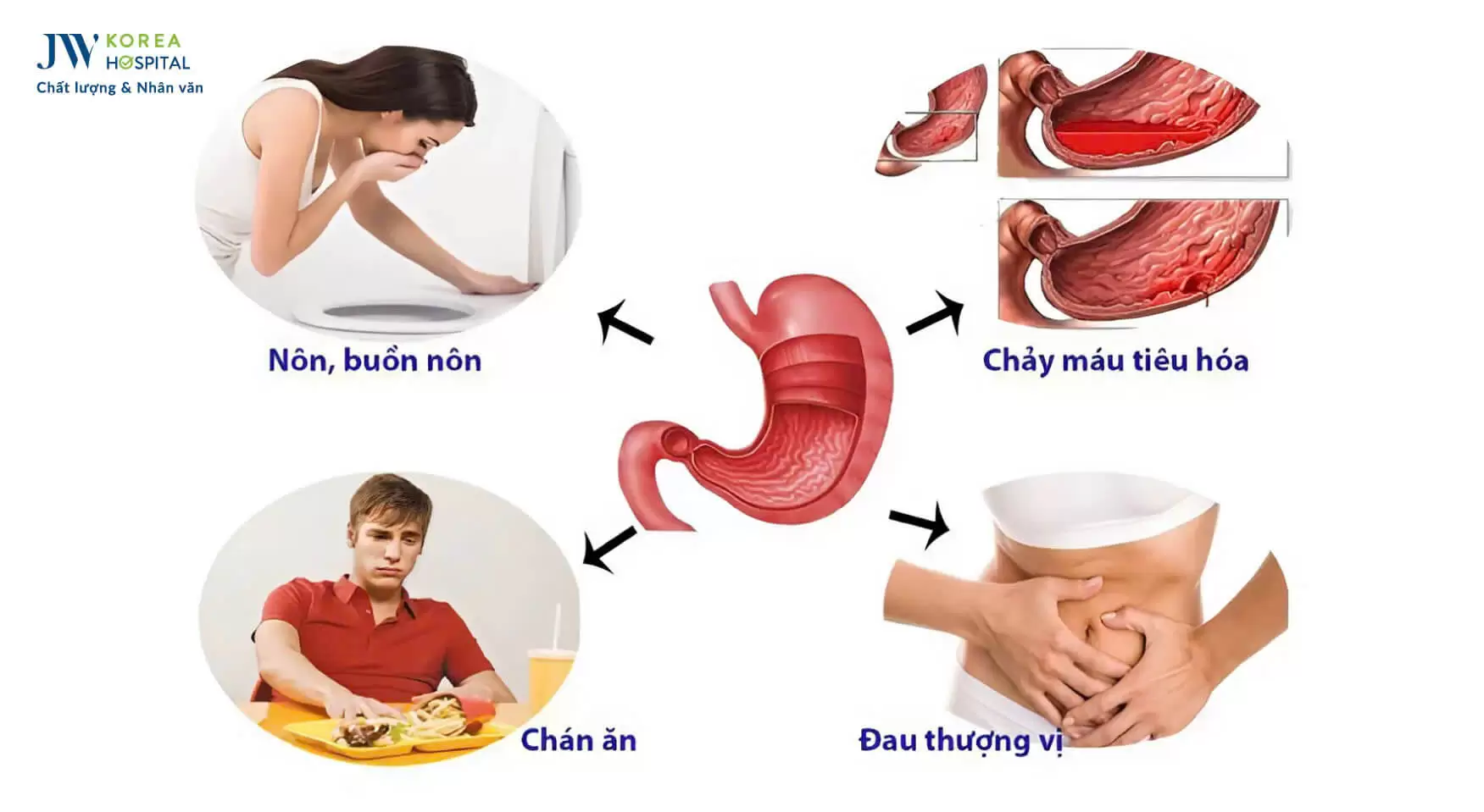 trieu-chung-viem-loet-da-day