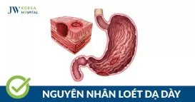 loét dạ dày