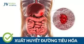 xuất huyết tiêu hóa