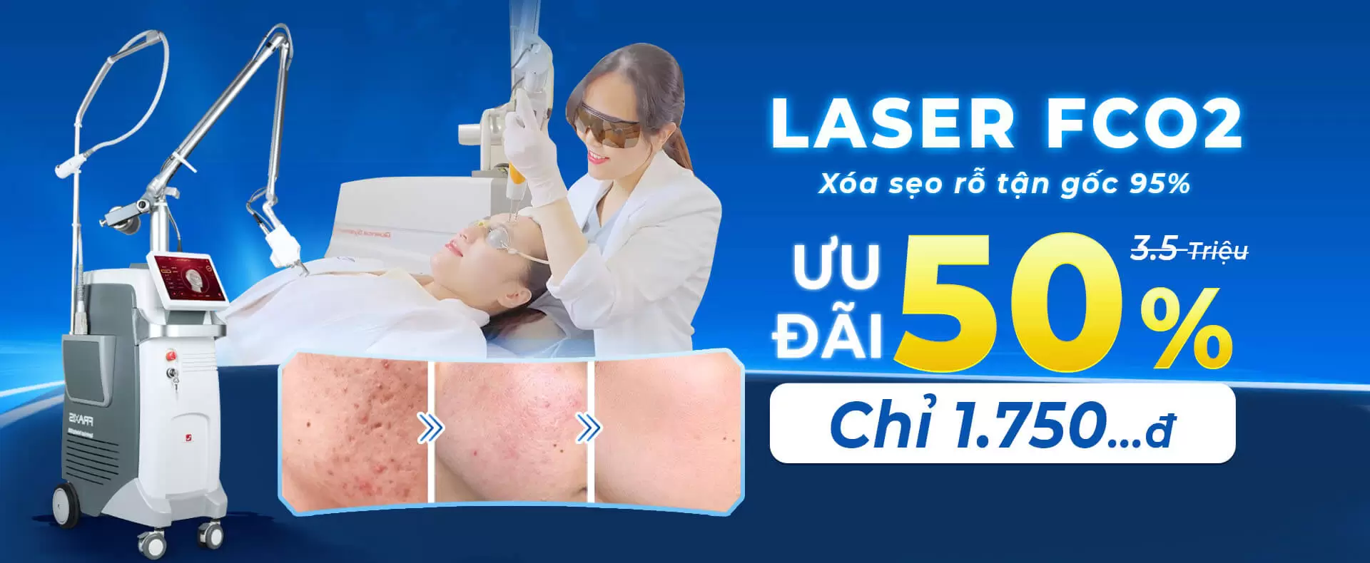 laser-seo