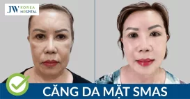 thumb cang da mat smas