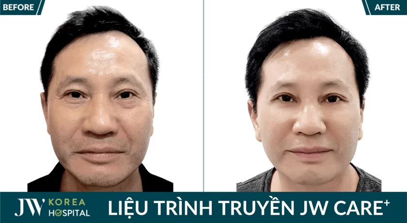 anh truoc sau khach hang 1