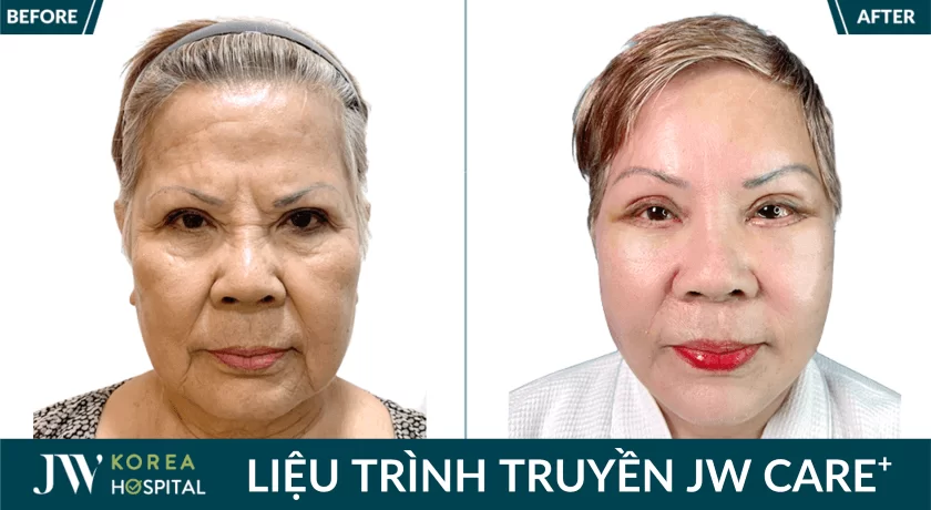 anh truoc sau khach hang 4