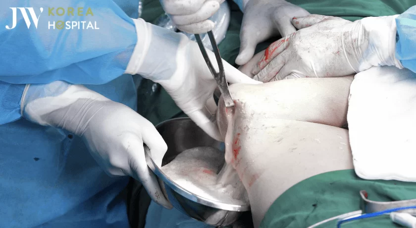 bac si jw tien hanh nao filler