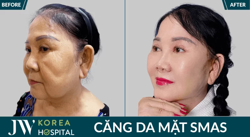 bf af cang da mat