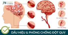 dau hieu va phong chong dot quy