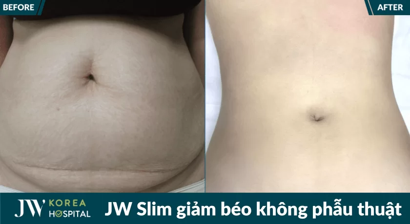 jw slim 21 2