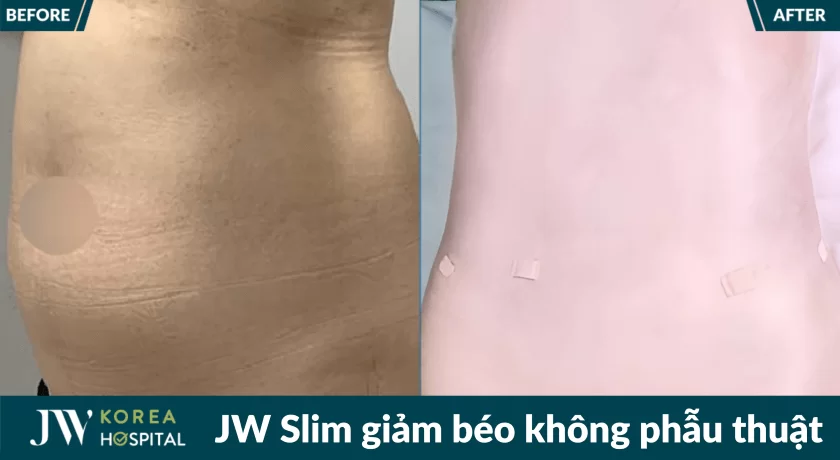 jw slim 22