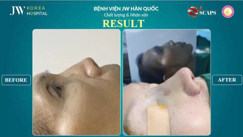 nang mui sun suon