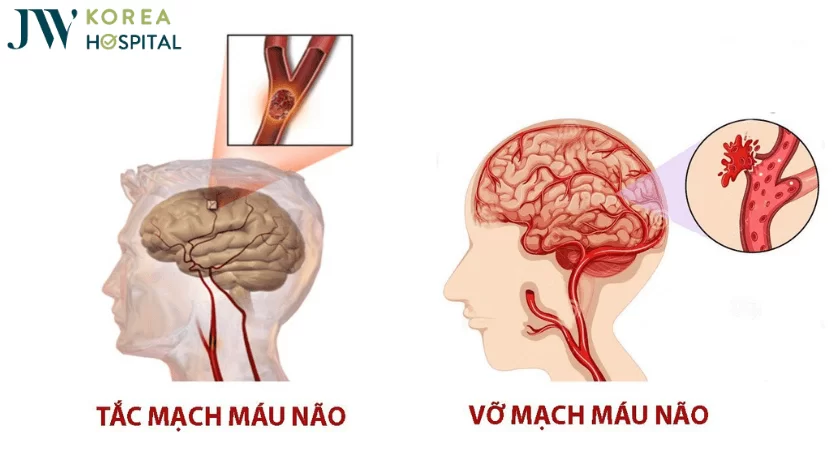 tat mach mau nao