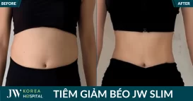 thumb jw slim (1)